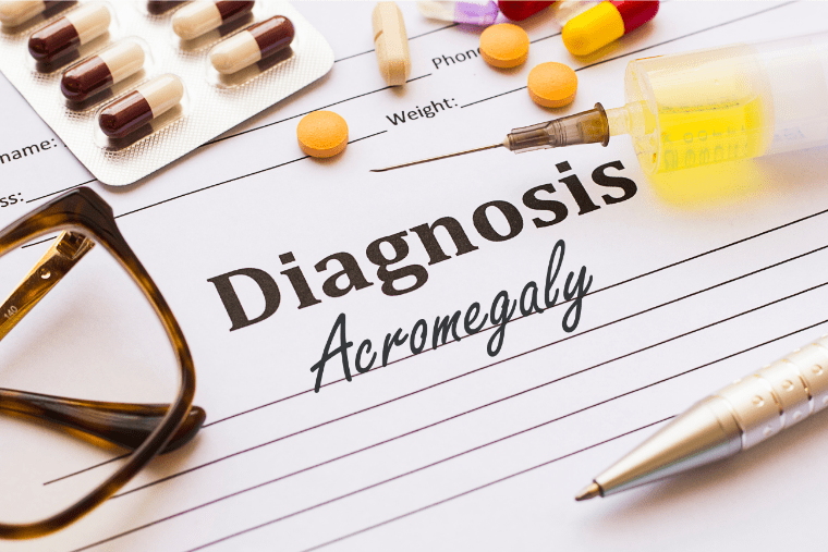 Treatment of Acromegaly Studies