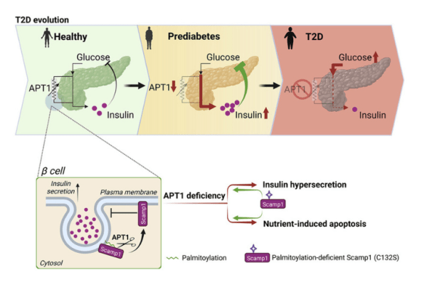 Semenkovich Lab and collaborators show the evolution of type 2 diabetes through APT1 deficiency 