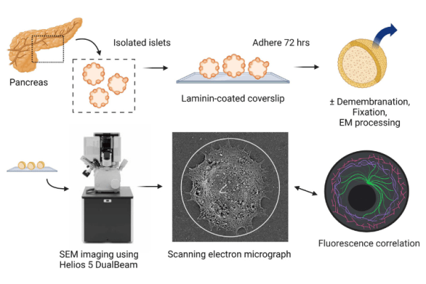 Hughes publishes research on scanning electron microscopy of human islet cilia 